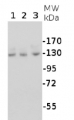 PFOR | pyruvate oxidoreductase